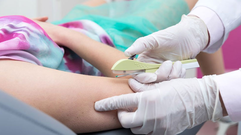 Implanon Insertion and Removal